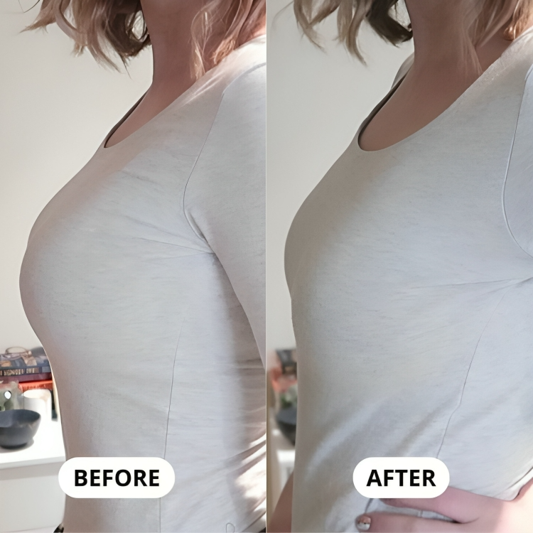 2+1 GRATIS | SlimFit™ - Ein BH, der Ihre Brüste sanft verkleinert!