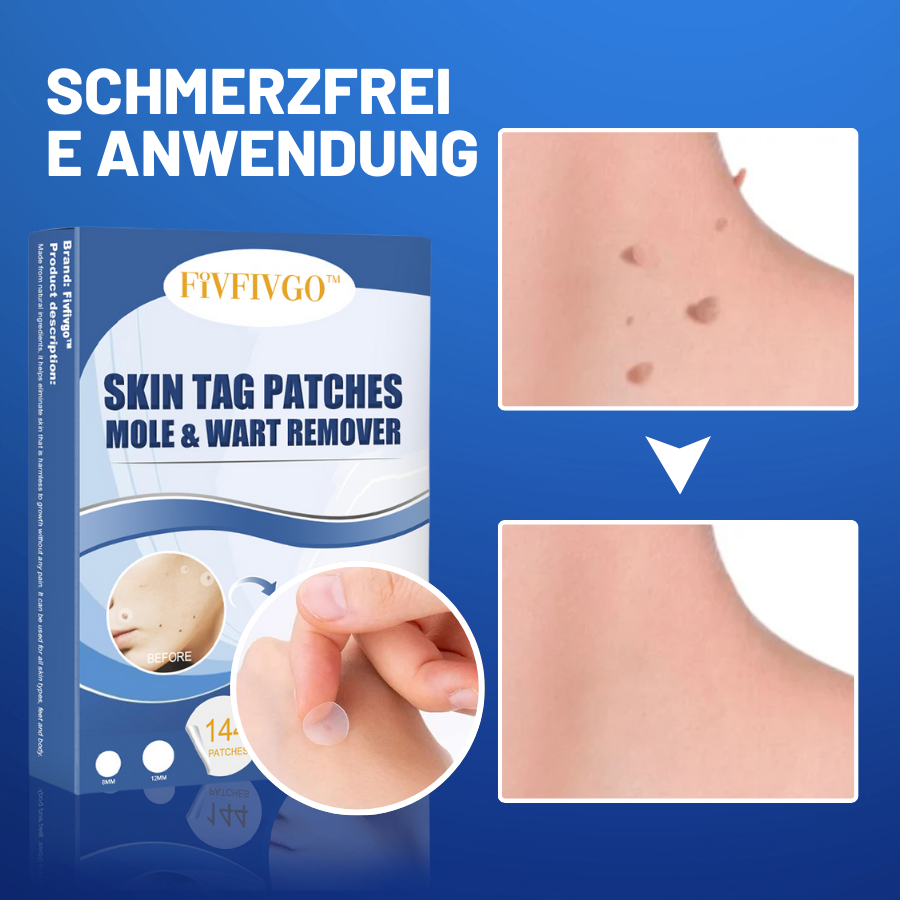 50 % Rabatt | PatchAway™ | Hautflapjes schmerzfrei und mühelos entfernen