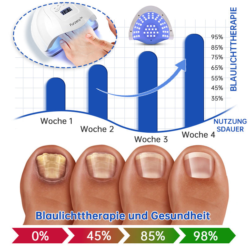 PureNail™ | Lasertherapiegerät gegen Nagelpilz