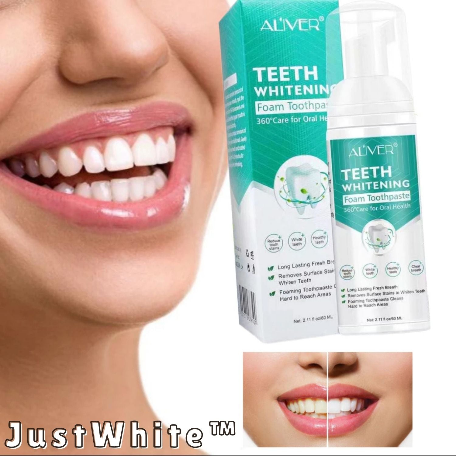 1+1 Gratis | JustWhite™ | Entfernt Flecken & Aufhellend | Frischer Atem & Natürlich Sicher