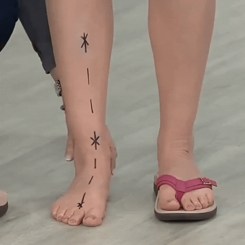 50% Rabatt | ComfortStride | Orthopädische Sommersandalen